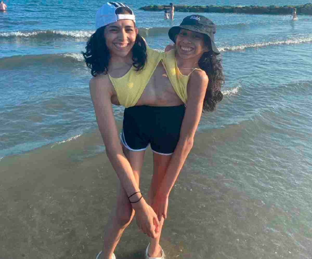 Siamese twins show on social media what it's like to share the same body. Photo: Instagram reproduction