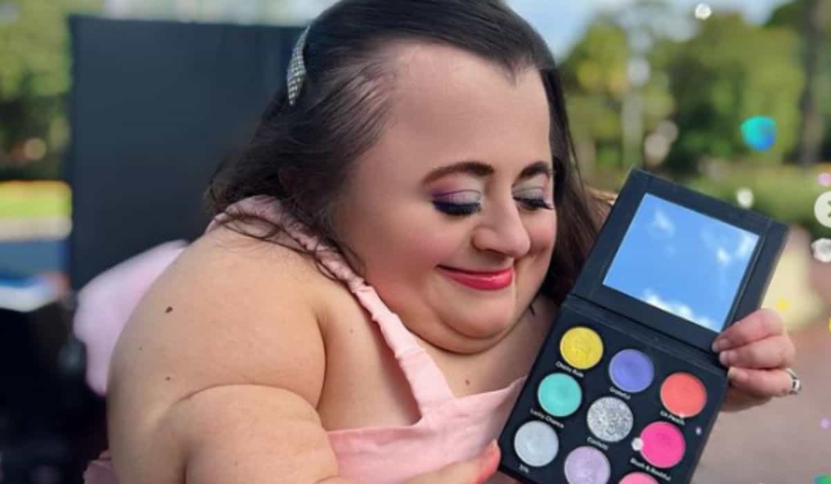 Meet the inspiring story of a woman with a rare condition who became a successful influencer